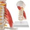 EVOTECH SCIENTIFIC Cervical Spine Anatomical Model with Brainstem, Muscles, Thoracic