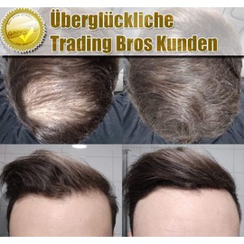 XXL Premium Scattered Hair Thickening Trading Bros Magic Hair Fibres Black 28 g