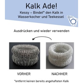 Kessy® Stainless Steel Limescale Catcher (Pack of 2) for Kettles and Tea Kettles - Durable | Reusable | Rustproof | Sustainable | Dishwasher Safe