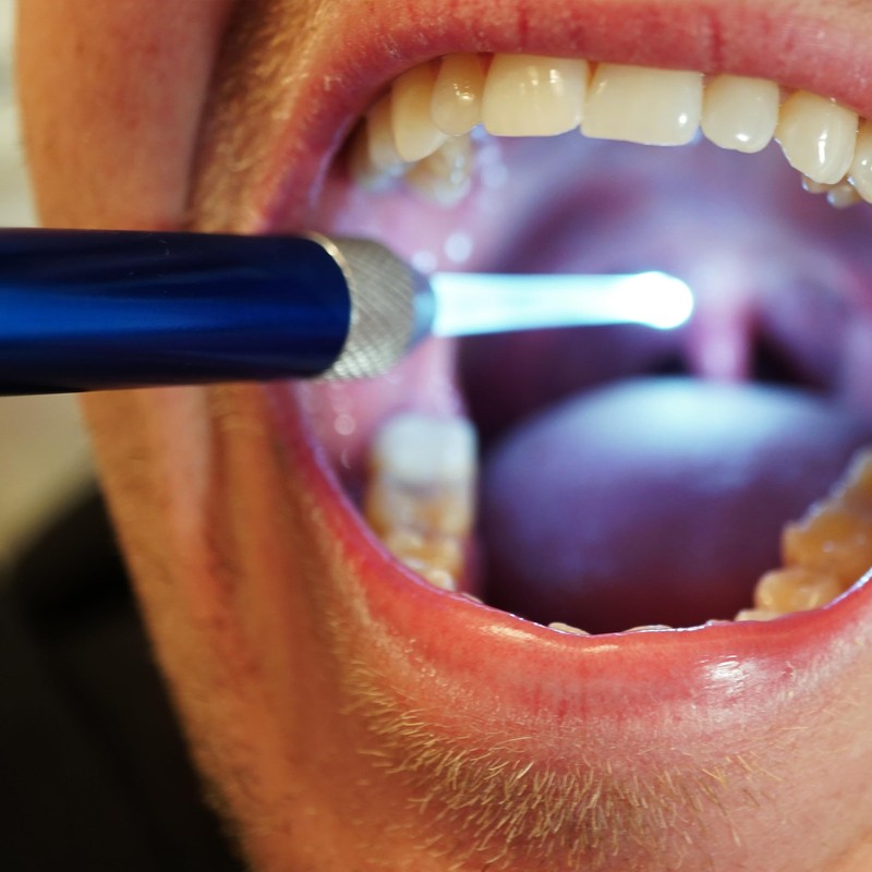 Generic Premium Tonsil Stone Remover Kit, Metallic