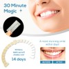 Professional Teeth Whitening Strips, Teeth Whitener Kit Pack of 28
