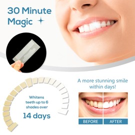 Professional Teeth Whitening Strips, Teeth Whitener Kit Pack of 28 Safe and Easy to Use