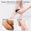 Foot Scrubber Callus Remover, Glass Foot File Callus Remover for
