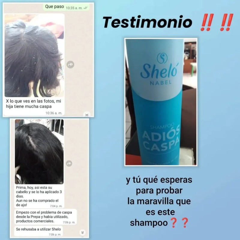 2 Shampoo Adiós Caspa / Comezón & Resequedad + Regalo