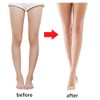 Leg Positioning Corrector Strap, Leg Correction Belt, Set of 3