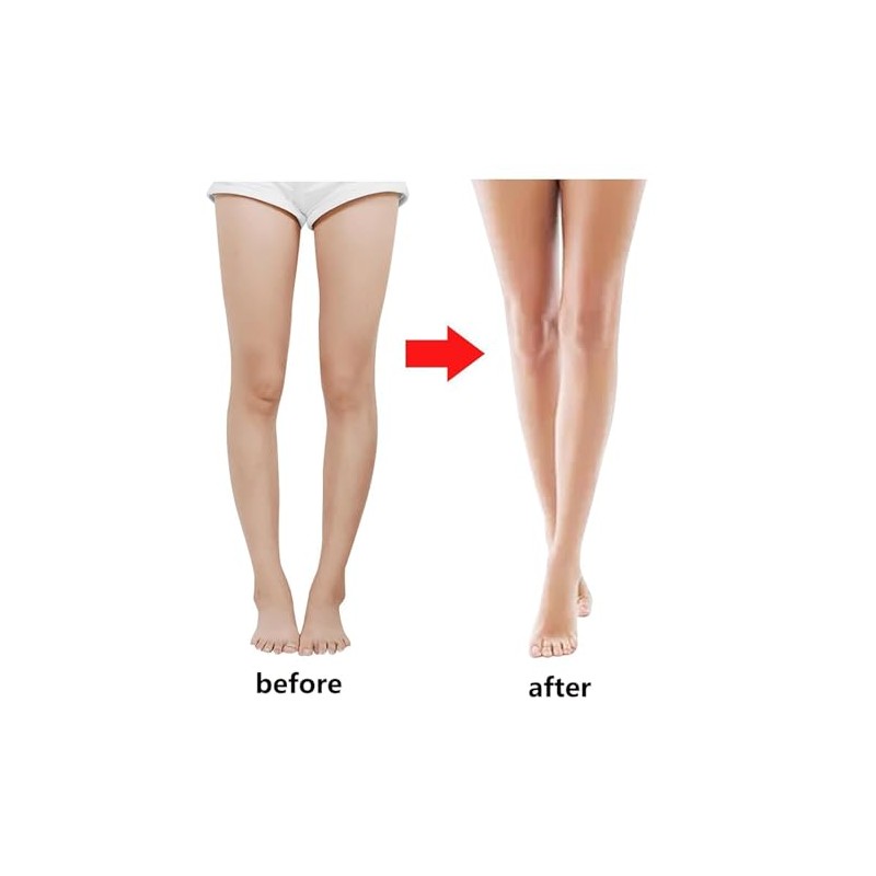 Leg Positioning Corrector Strap, Leg Correction Belt, Set of 3