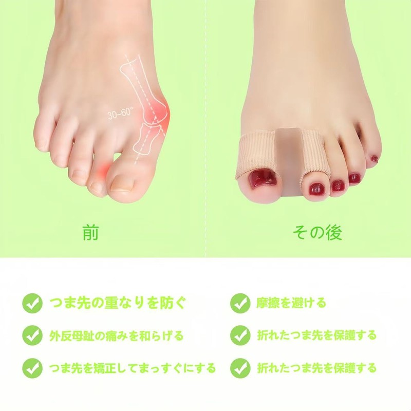 KUENZ 足指サポート 足指を広げる 足指サポーター お 睡眠足指ストレッチパッド、足指ストレッチパッド、ユニセックスで着脱が容易 2枚入り (S:2足組)