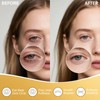 Fanterday Under Eye Patches - Eye Mask for Puffy Eyes