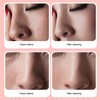 Blackhead Remover Blackhead Absorption Instrument Electric Pore Vacuum Machine Facial
