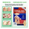 Parches Antimicóticos For El Tratamiento De Uñas