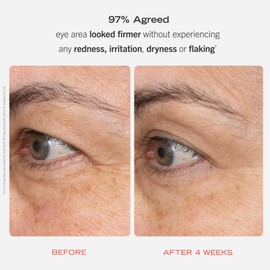 First Aid Beauty Retinol Eye Cream with Squalane + Ceramides – Visibly Smooths Fine Line & Wrinkles Around the Eyes – 0.5 oz.