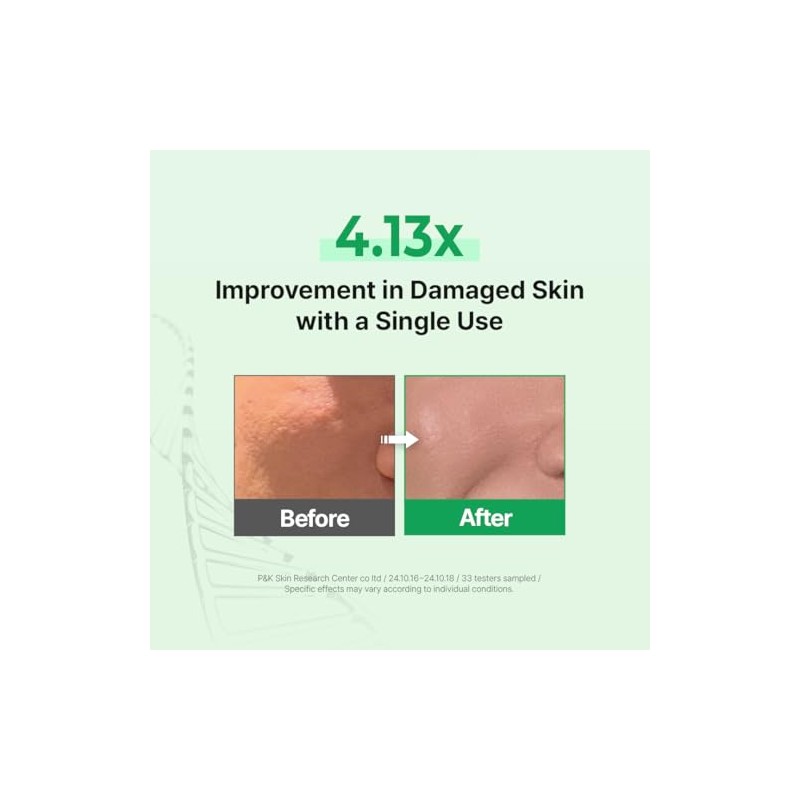Z+piderm - Zipiderm Egf Espuma Limpiadora Profunda – Limpiador Facial