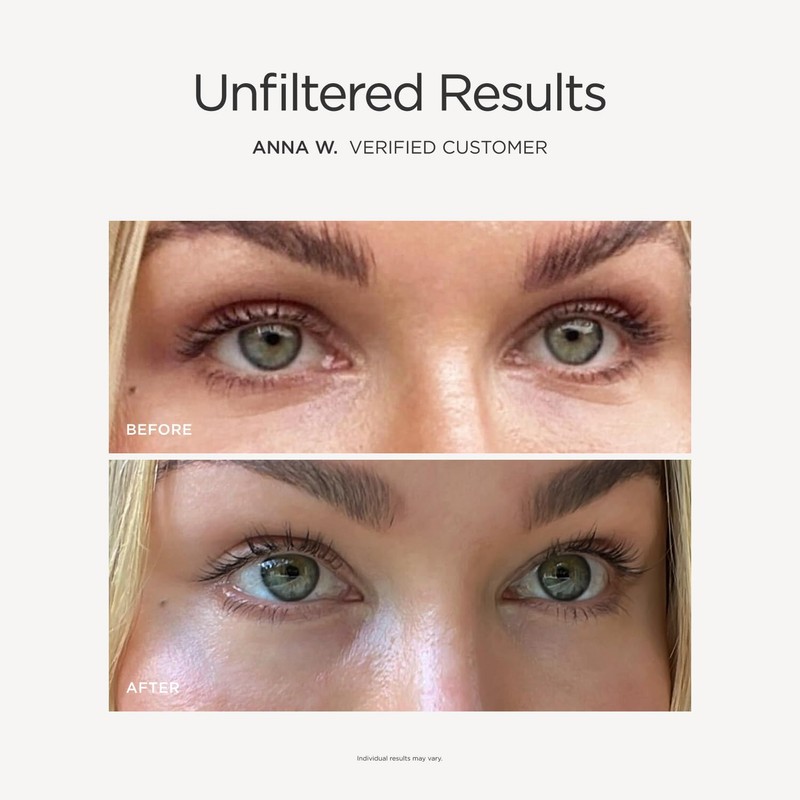 JSHealth Illuminating Peptide Eye Serum - Under Eye Brightener Serum