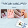 Crema Para El Cuidado De Las Uñas Para Morderse Las