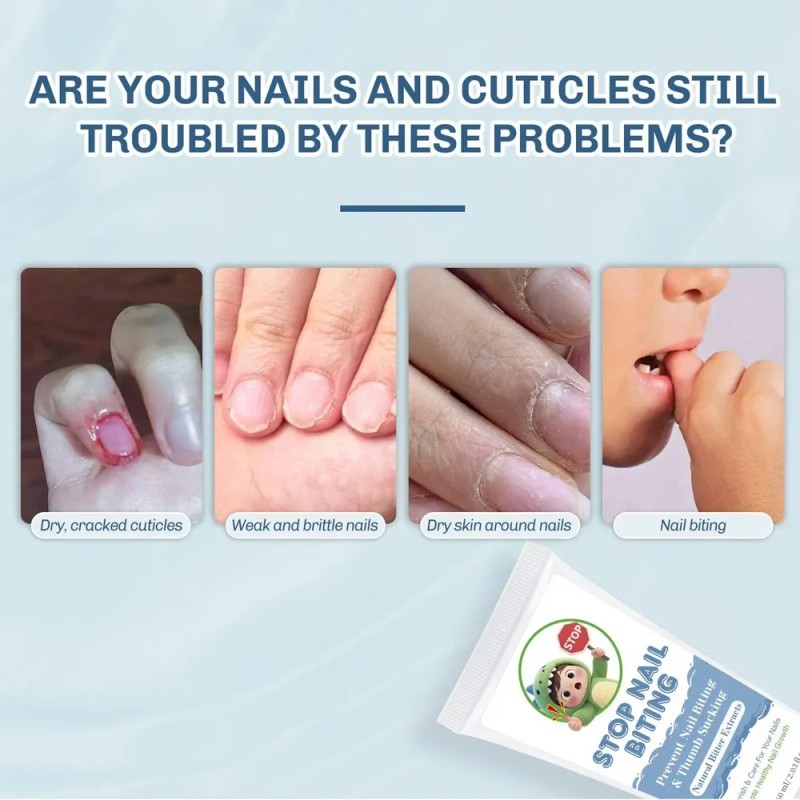 Crema Para El Cuidado De Las Uñas Para Morderse Las