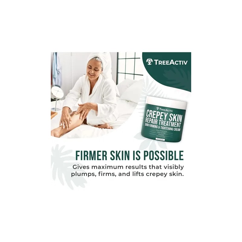 Treeactiv Crepey Skin Repair Treatment, 8oz, Crema Reafirman