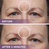 Dermaflage Scar Filler Kit - Medium Cool - Deep Scar