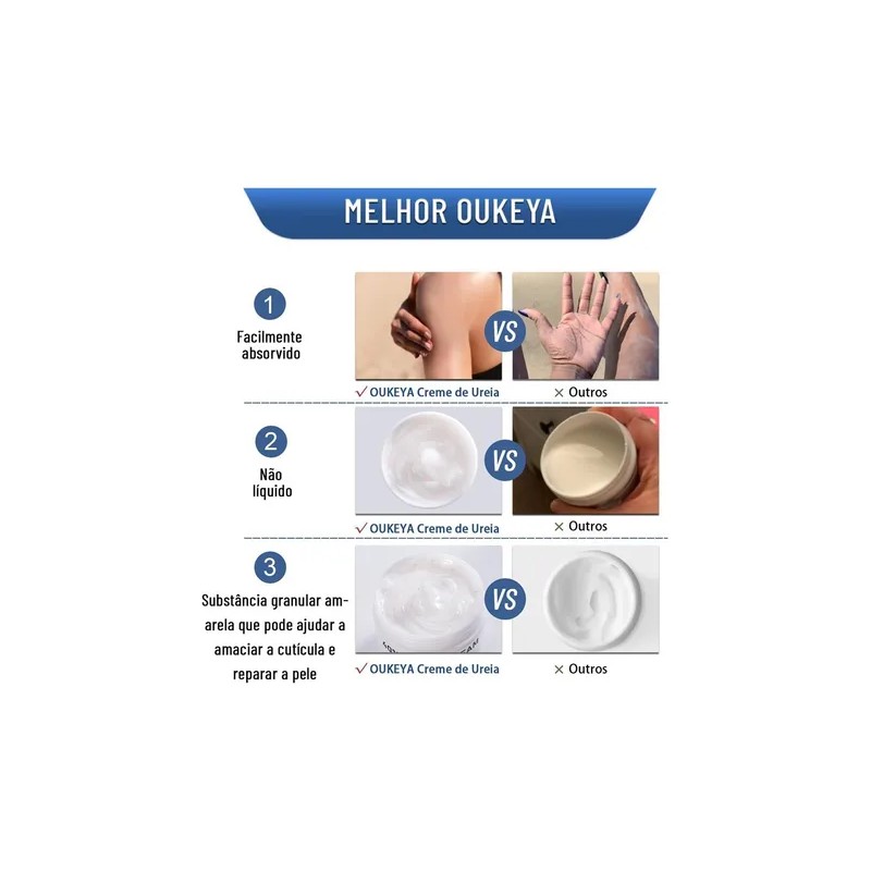 Bt Crema For Pies Y Manos Crema De Urea 1