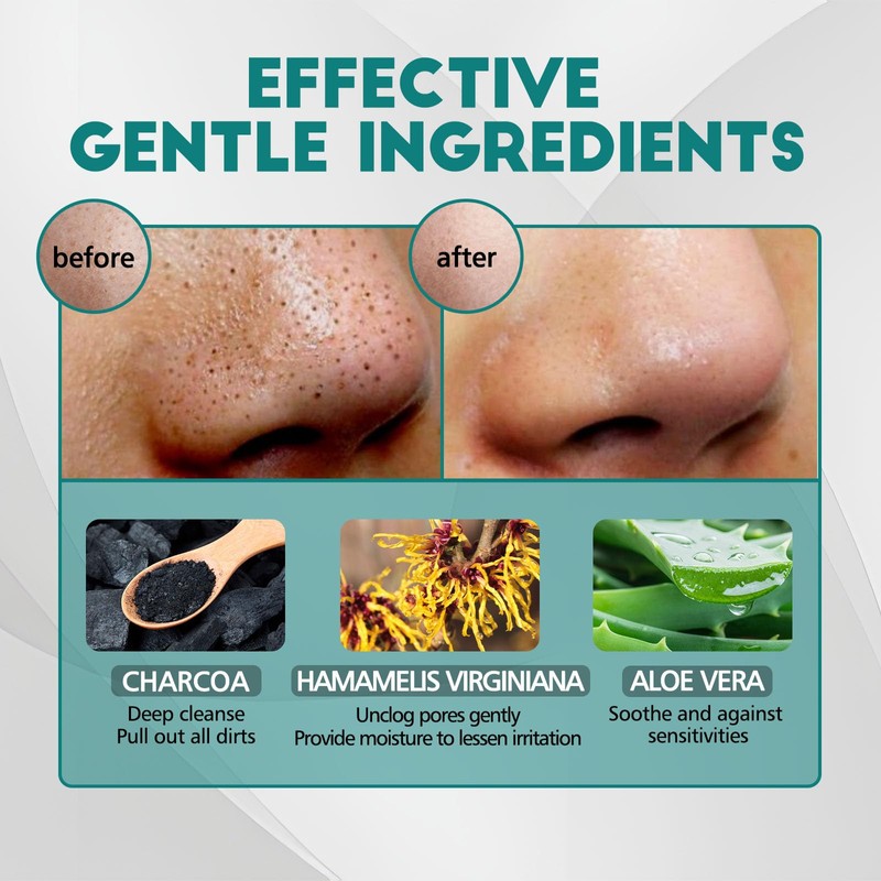 Mitesserentferner Stripes, 80 Stück Natürliche Bambuskohle Mitesser Entferner, Zum Entfernen