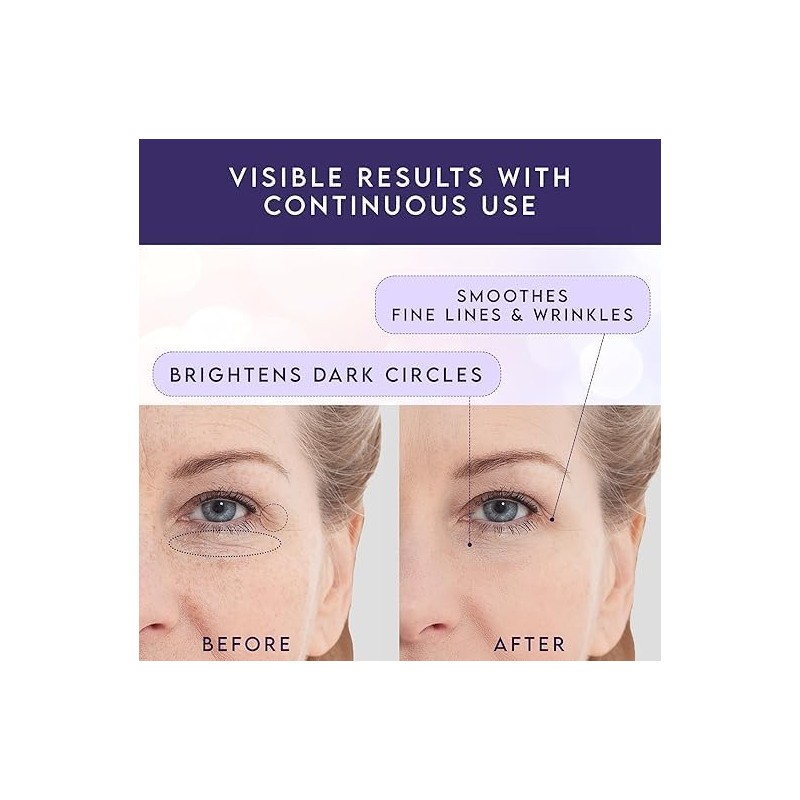Retinol Eye Stick & Caffeine Under Eye Brightener – Under