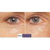 RETINOL VITAMIN A 5% + HYALURONIC ACID + Vitamin E