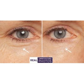 RETINOL VITAMIN A 5% + HYALURONIC ACID + Vitamin E - WRINKLE SERUM / CREAM