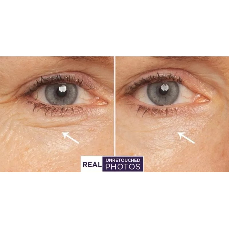 RETINOL VITAMIN A 5% + HYALURONIC ACID + Vitamin E