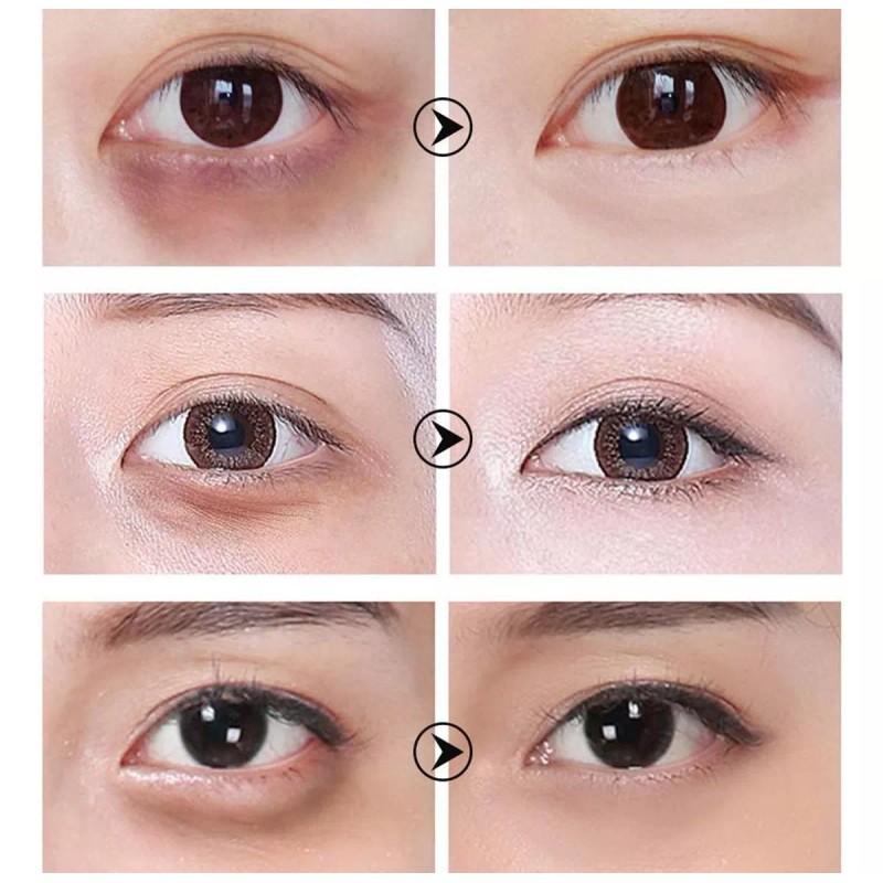 Vanella Monterrey Parches De Ojos Elimina Ojeras Hidrata Bolsas Full