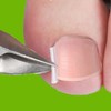 Ingrown toenail care wire tip band 10P for toe correction Ingrown toenail tip 10p 8ea