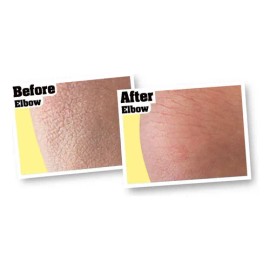 Loción Reparadora Corporal O'keeffe's Skin Repair Piel Seca