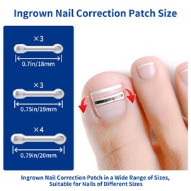 Ingrown Toenail Treatment, 10 packs Titanium Alloy Ingrown Toenail Corrector for all size foot, Ingrown Toenail Removal Kit for Curved Nail Repair, at Home Nail Kit Tools-Blue3