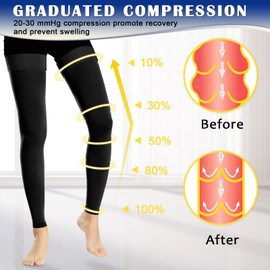 Ailaka Medical Compression Stockings for Women Men, Thigh High Footless 20-30mmHg Graduated Compression Socks with Silicone Band for Varicose Veins, Edema, Post-Surgery