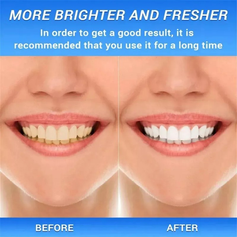 Crema Dental Xinnuo Er, Crema Dental Branqueador*