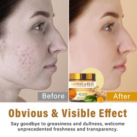 Turmeric Kojic Acid Pads, Turmeric Pads for Dull Skin, Remove Excess Keratin, Nourishing & Firming The Skin-All Skin Types(70pads)