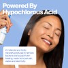 Magic Molecule Hypochlorous Acid Spray for Breakout-Prone Skin, Eczema &