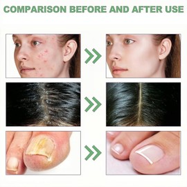 Organic Golden Castor Oil Roll-On,Natural Cold Pressed Castor Oil,Moisturising Body Oil with Rose Quartz Roller,Essential Oils for Skin,Body Oil for Dry Skin,Hair Oil For Dry Hair,Massage Oil