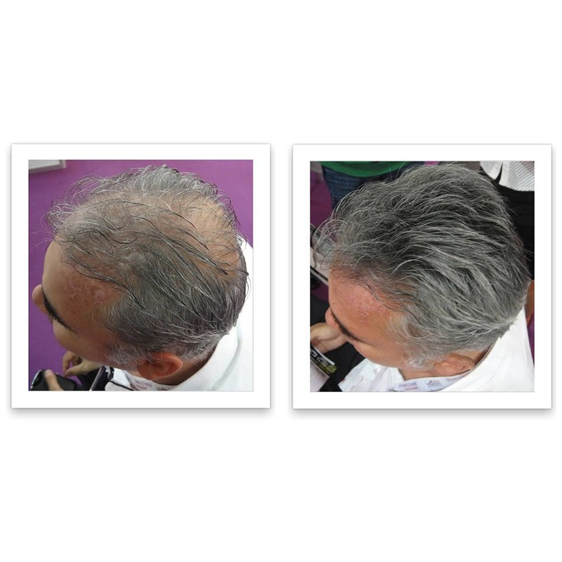 Caboki Hair Loss Concealer Trial Pack (Light Brown)