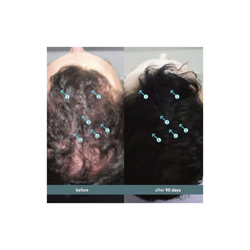 Ds Laboratories | Spectral® F7 Tratamiento Capilar con Ingredientes que
