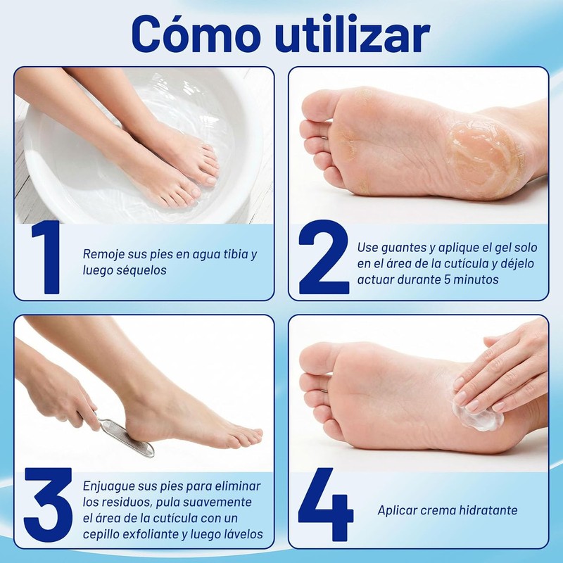 Foot Callus Remover Gel Extra Strength 6 oz – GIVOOBE