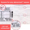 Yeanifeana ECG 7 regla de pasos, ECG 7 regla de