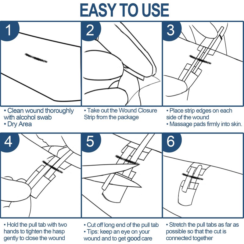 Wound Closure Strips - Emergency Laceration Closure Kit to Repair