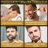 TECHEEL Bartöl Herren Bartwachstum Öl Beard Growth Kit mit Bartroller