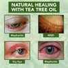 NOVEHA Tea Tree Oil Anti Wrinkle Eye Cream - Eyelid