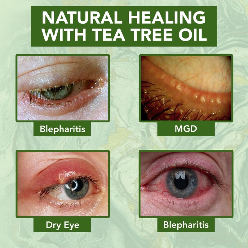 NOVEHA Tea Tree Oil Anti Wrinkle Eye Cream - Eyelid