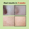 Sungboon Editor Ampolleta Green Tomato Pore Lifting Ampoule de 30ml