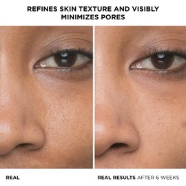 IT Cosmetics IT Cosmetics Bye Bye Pores 10% Glycolic Acid Face Serum - Visibly Minimizes Pores In 1 Week & Gently Exfoliates to Help Refine Skin's Texture - With Hyaluronic Acid for Hydration -1 Fl. Oz