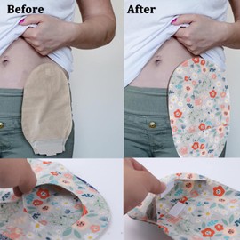 GLUKIEWT Ostomy Bag Covers - 3pcs Colostomy Bag Covers Odor Reducing Ostomy Pouch Covers, 3 inch Round Opening Colostomy Bag Covers For Men Or Women, Ileostomy, Washable