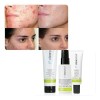 Skincare Acné Kit Anti Imperfecciones Clear Proof Mary Kay