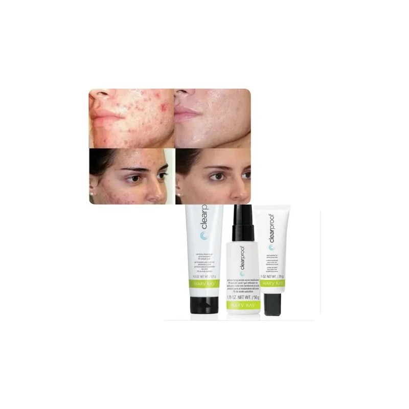 Skincare Acné Kit Anti Imperfecciones Clear Proof Mary Kay