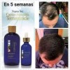 Set Anti Caída Shampoo Y Tratamiento Terramar + Gel